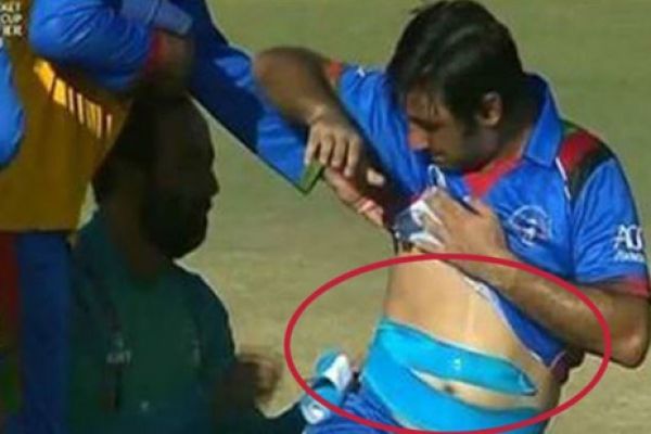Captain Are weird World Cup Afghanistan!