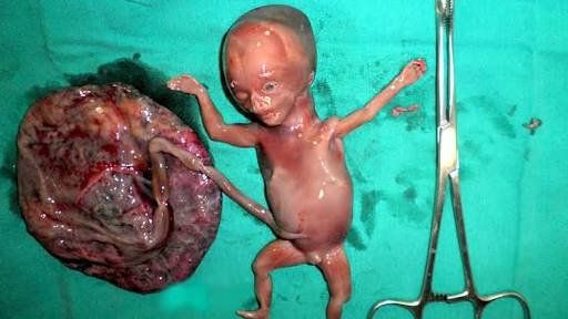 MY THOUGHT ON ABORTION: Air-clinic