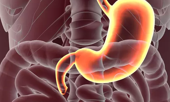 This is the difference between ulcer pain and gastric ulcers
