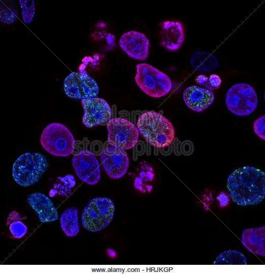 CURING DISEASES; TOPOISOMERASES INHIBITION