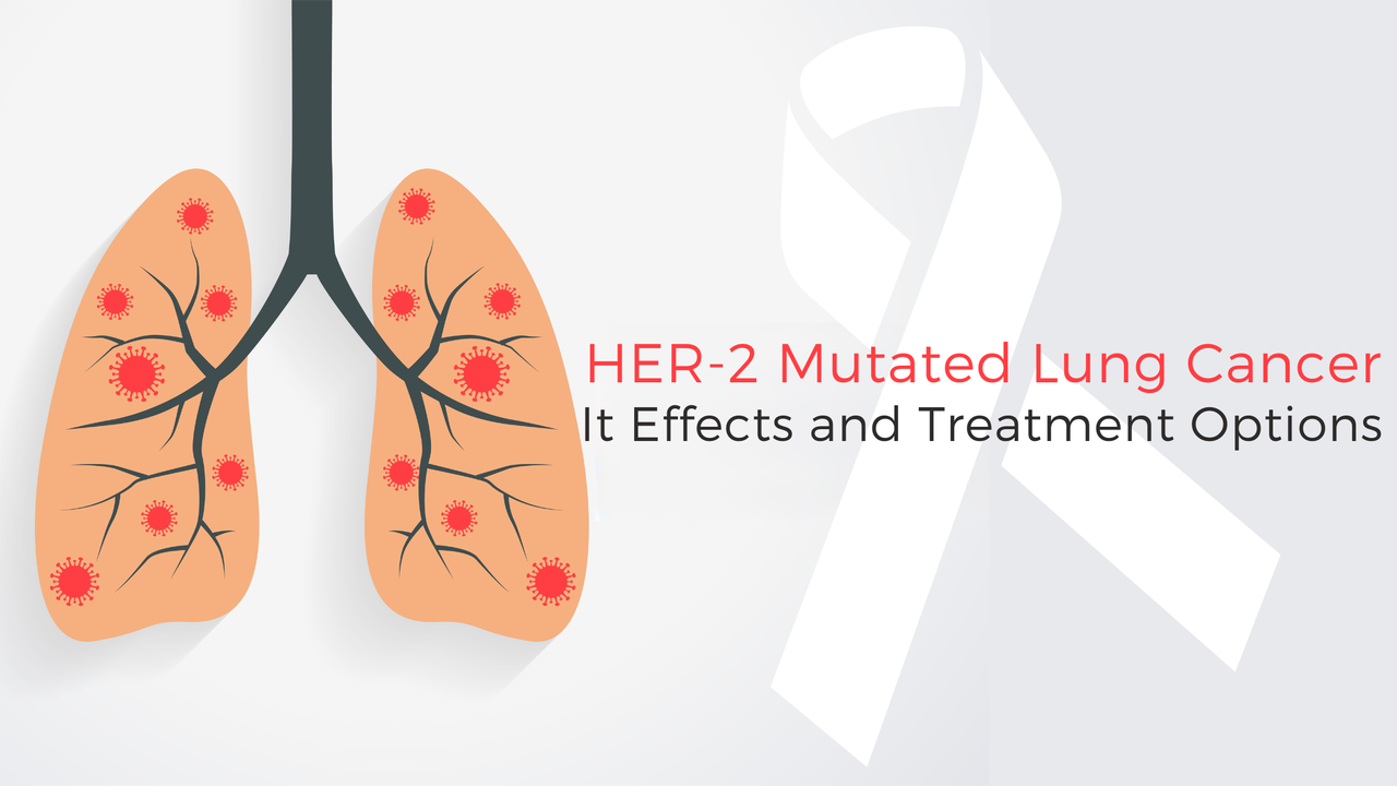 How HER2 Mutations Affect Lung Cancer and Treatment Options