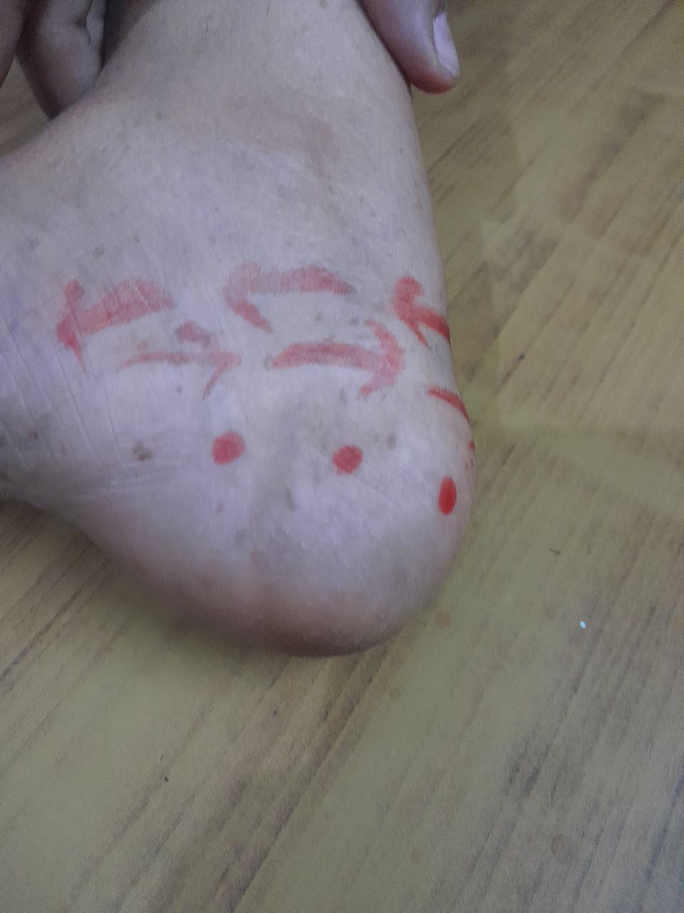 Heal pain therepi 