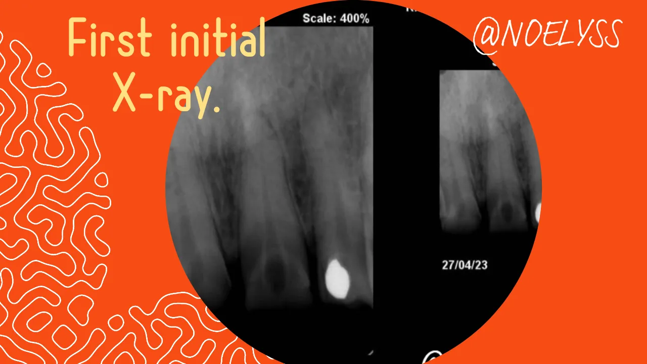 Adobe_Express_20230708_2233590_1.png