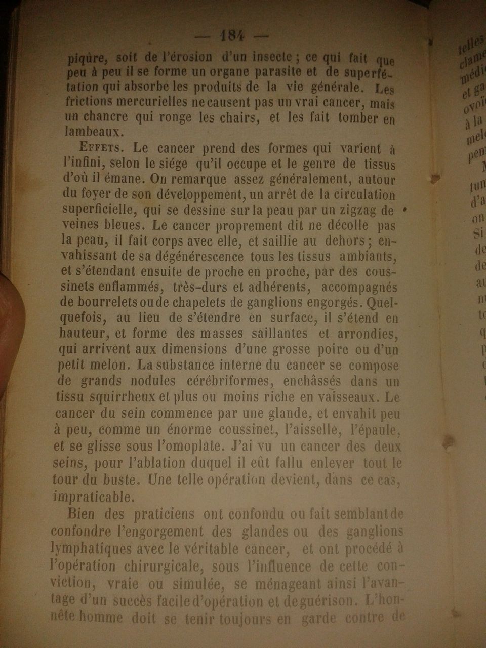 Manuel anuaire de la santé 1853 B Cancer2.jpg