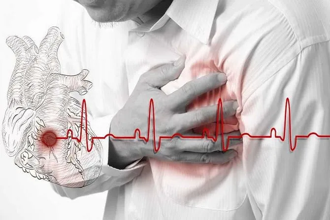 heart-attack-1.jpg