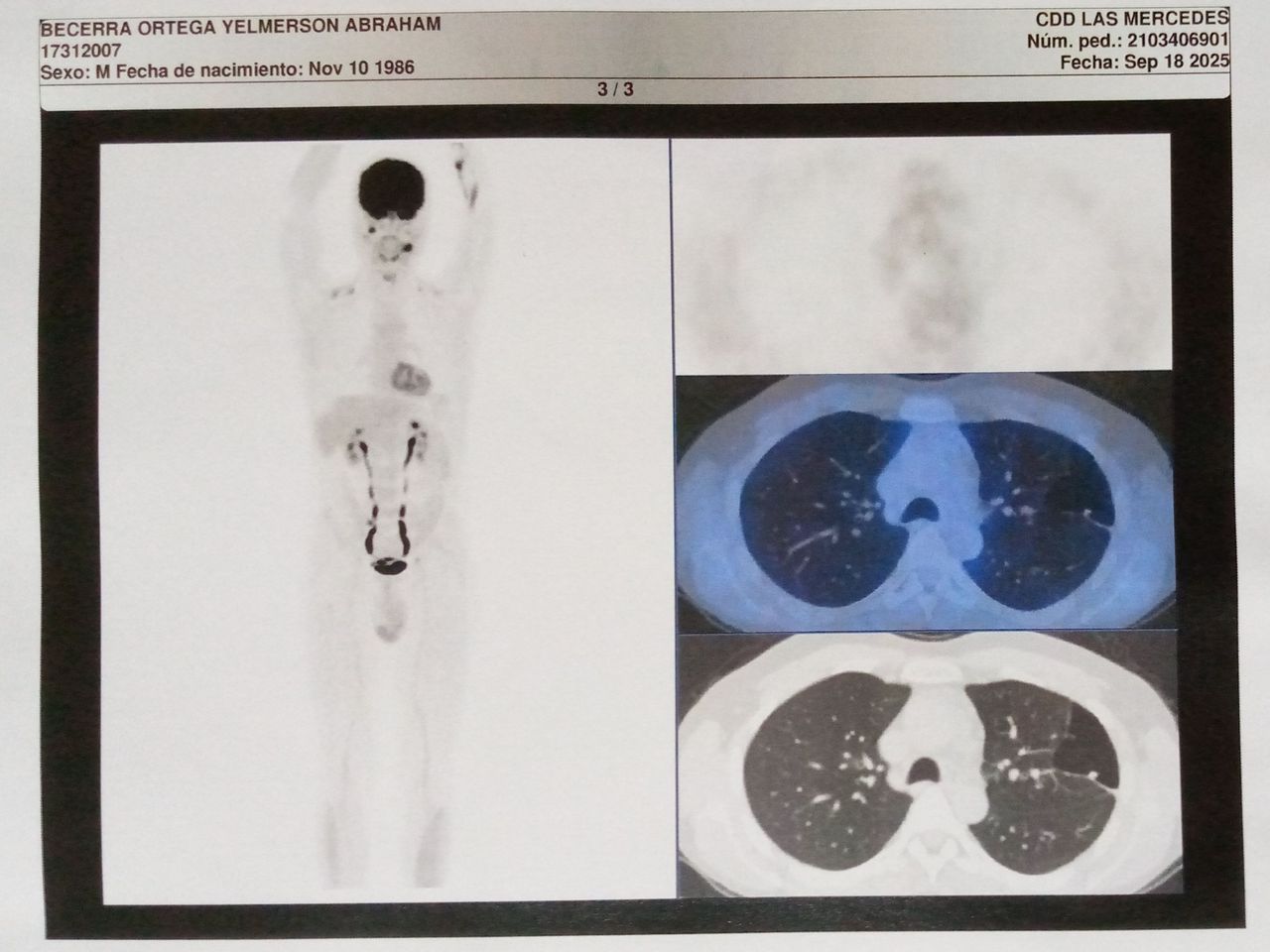 Imagen 03 PET-CT